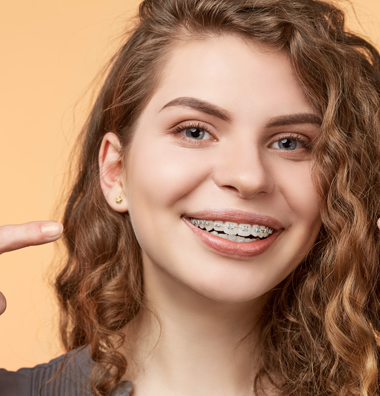 Benefits of ceramic braces