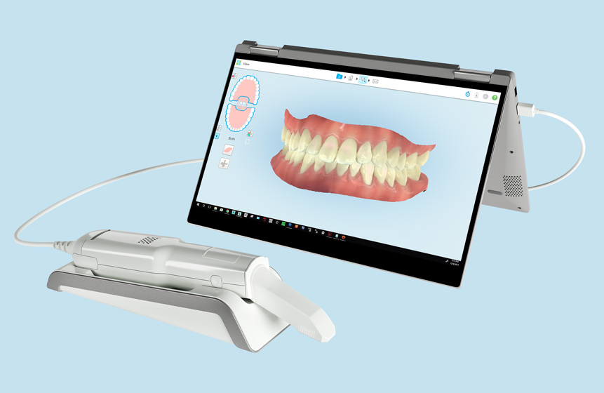 iTero 3D scanner